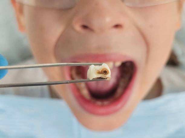Emergency Gum Pain Relief in WV