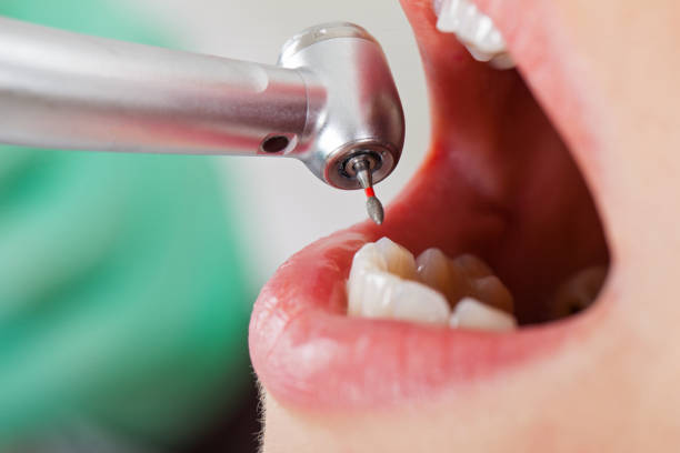 Best Root Canal Emergency Dentist  in Inwood, WV